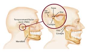 إلتهاب مفصل الفك Temporomandibular Joint Disease - TMJ
