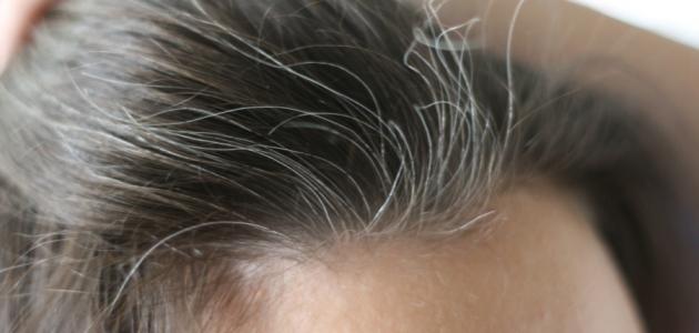 سبب ظهور الشعر الأبيض المبكر