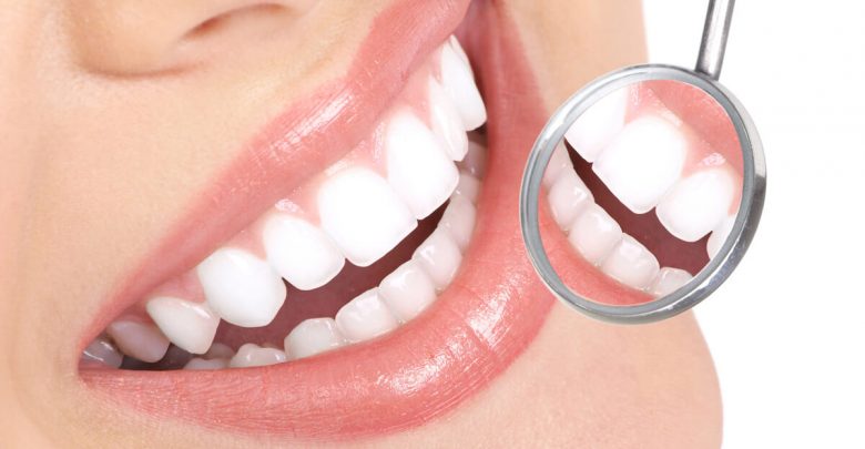 افضل طريقة لتبييض الاسنان بمكونات طبيعية