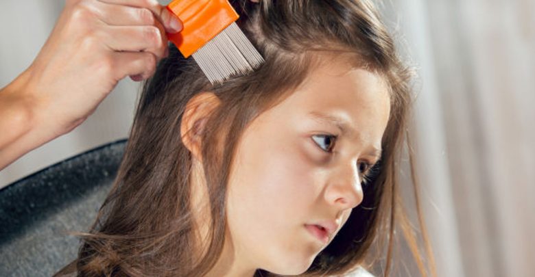 علاج تقصف الشعر من الامام عند الاطفال