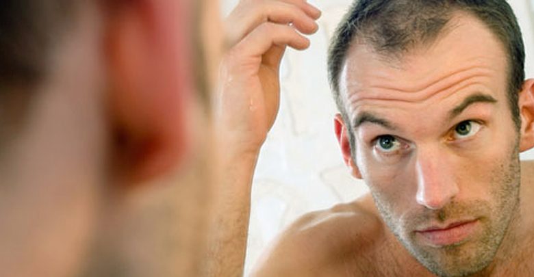 عصير البصل والعسل لعلاج تساقط الشعر عند الرجال