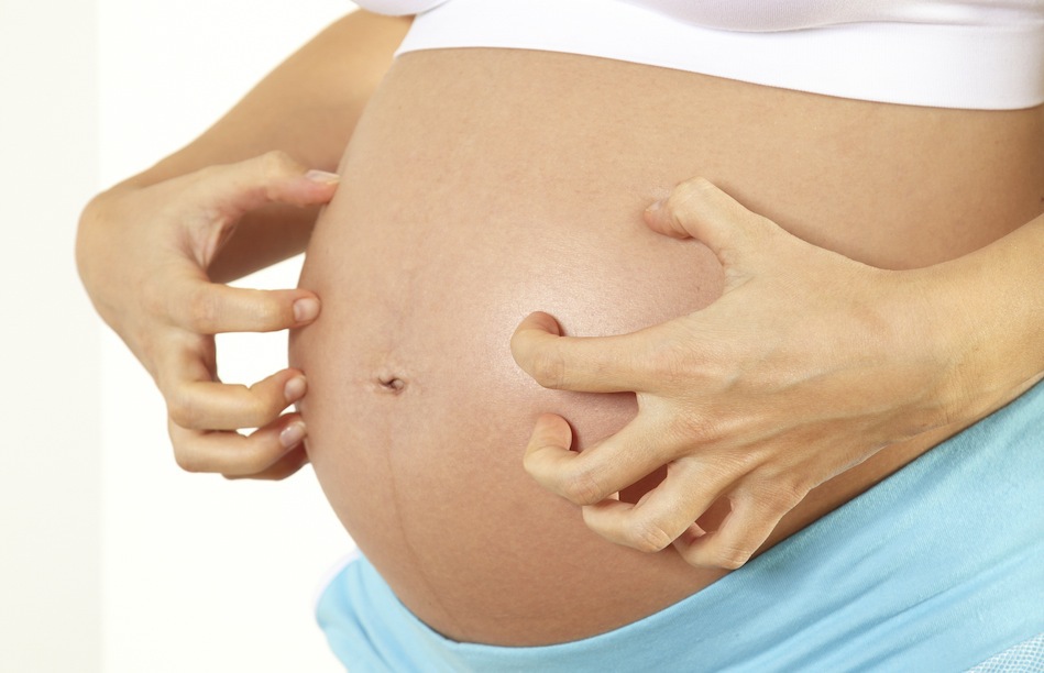 ما هي اعراض حساسية الحامل وطرق العلاج مجلة رجيم