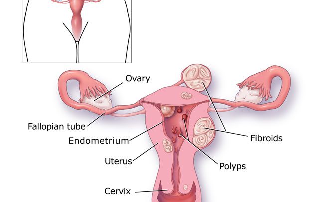 تاثير اضطراب الدورة الشهرية على الحمل