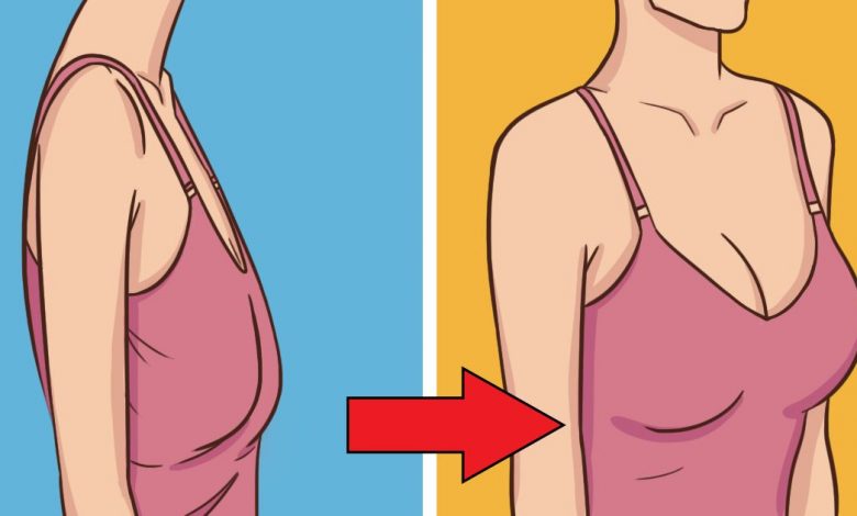 ترهل الثديين بعد الرضاعة