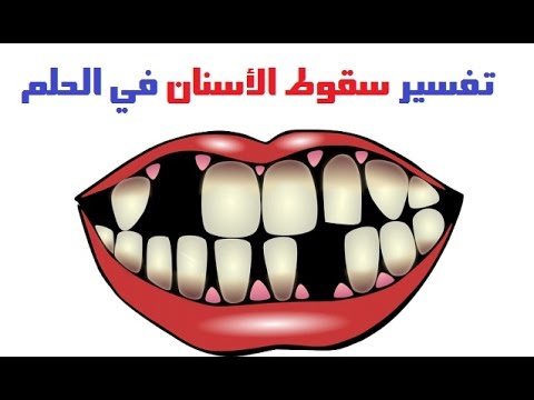 تفسير حلم طيح الاسنان