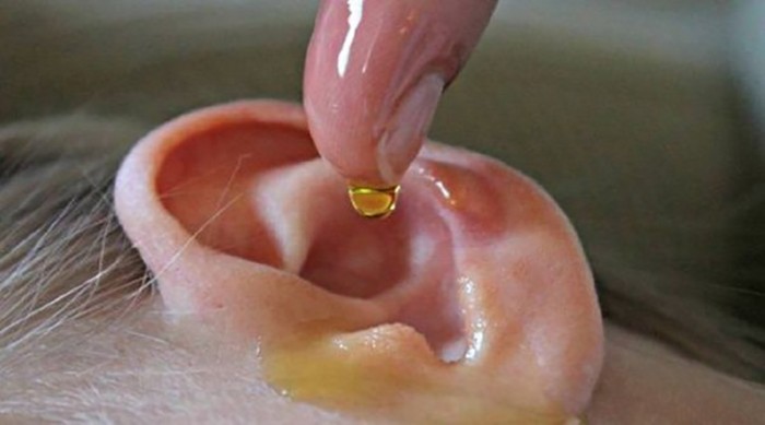 علاج التهاب الأذن الوسطى بزيت الزيتون