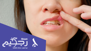 أفضل 9 طرق لعلاج تقرحات الفم 