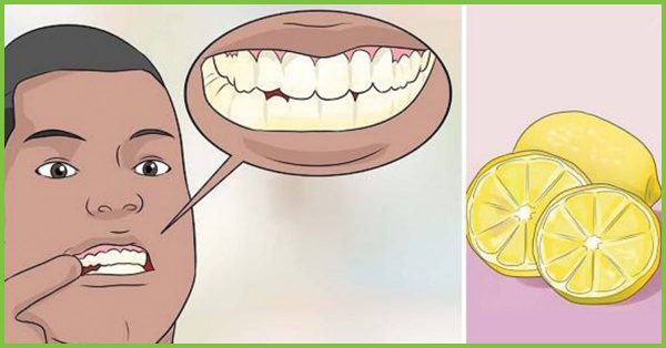 اضرار الليمون على الاسنان